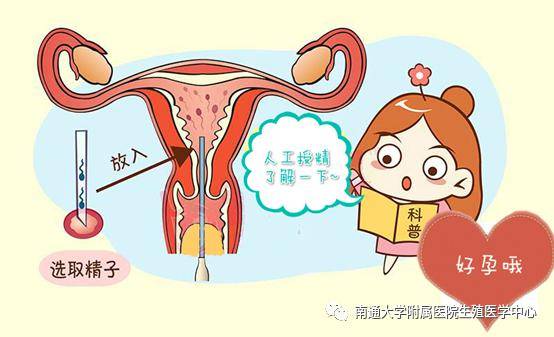 宫内早孕宫腔积液