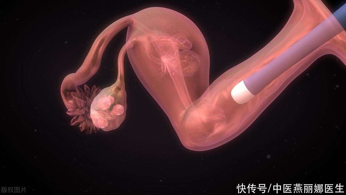 实拍分娩视频