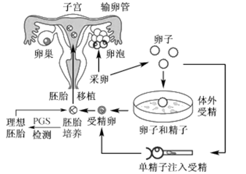 宫内早孕偏右侧宫角