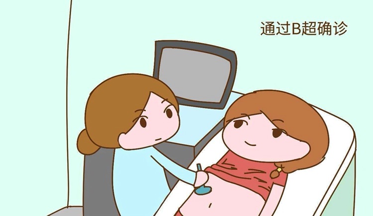 宫外孕