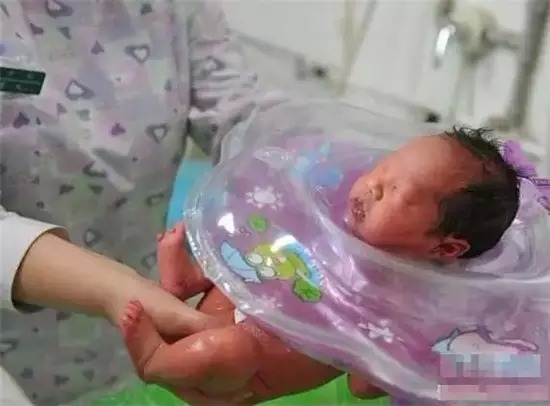 宫内早孕