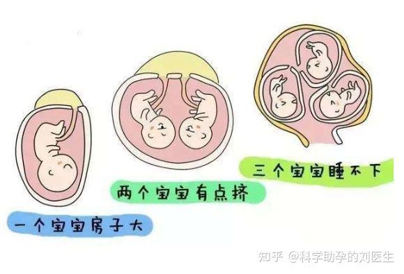 分娩