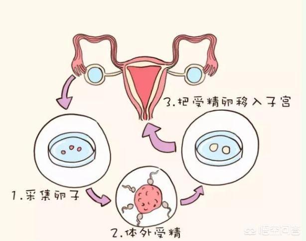 宫内早孕