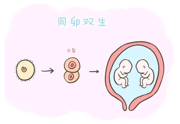 宫内异位妊娠